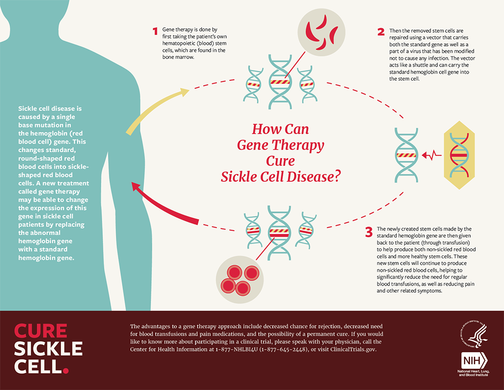 new research on sickle cell anemia